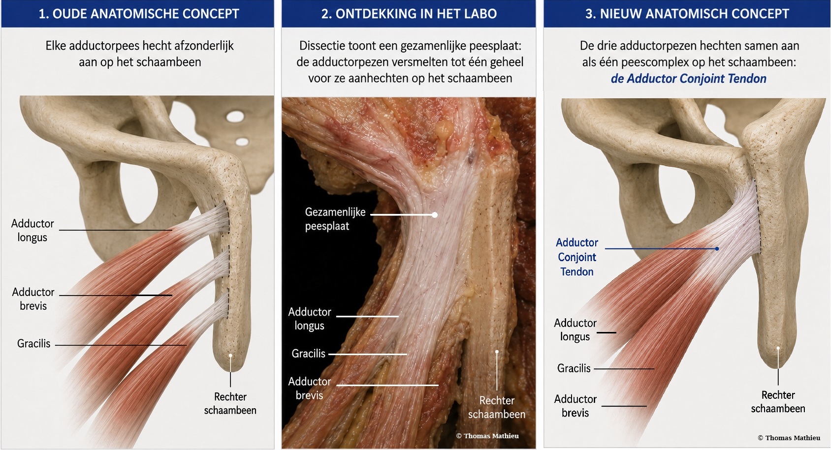 dr. Thomas Mathieu - nieuwe anatomische ontdekking AZ Rivierenland