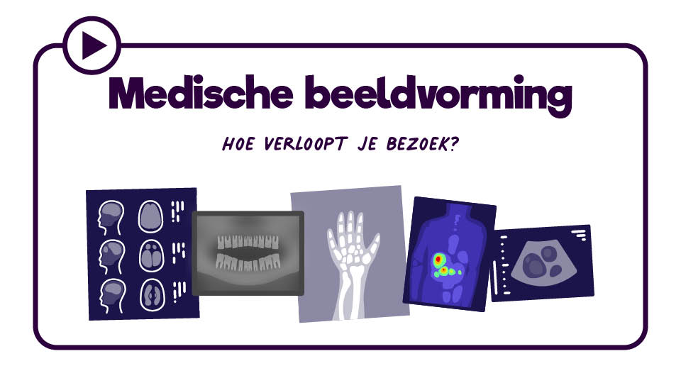 MBV: hoe verloopt jouw bezoek?