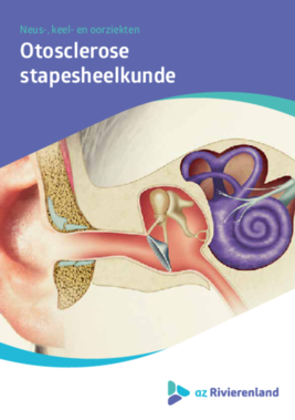 Otosclerose - stapesheelkunde