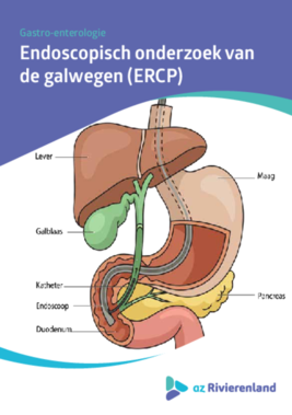 ERCP galwegen