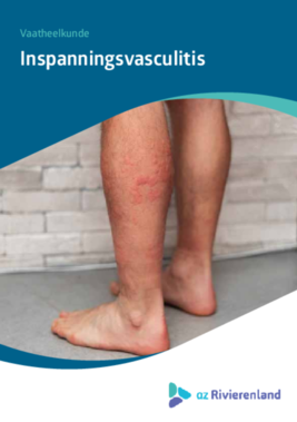 Inspanningsvasculitis 
