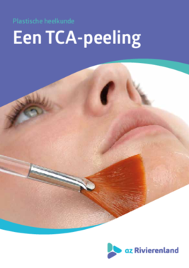 TCA peeling